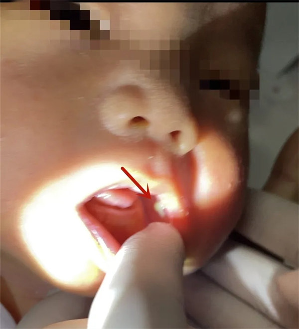 1.webp.jpg 1.webp.jpg