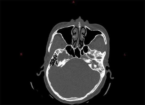 2.webp.jpg 2.webp.jpg