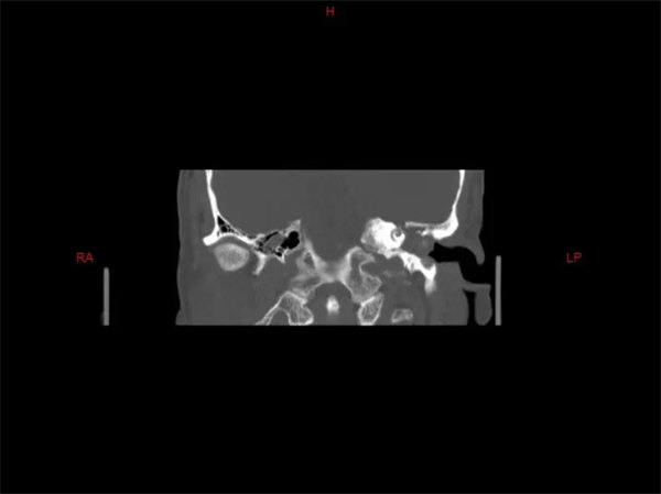 3.webp.jpg 3.webp.jpg