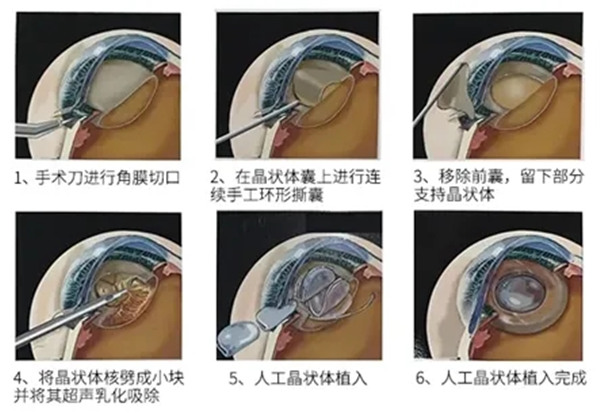 2.webp.jpg 2.webp.jpg