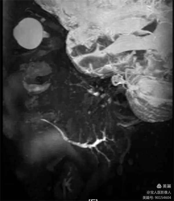 1.webp.jpg 1.webp.jpg