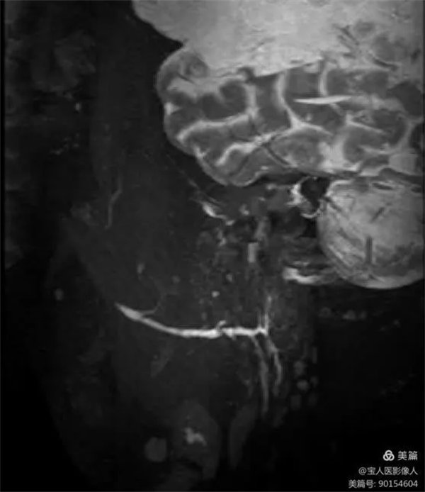 2.webp.jpg 2.webp.jpg