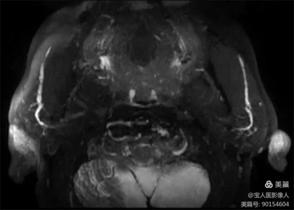 3.webp.jpg 3.webp.jpg