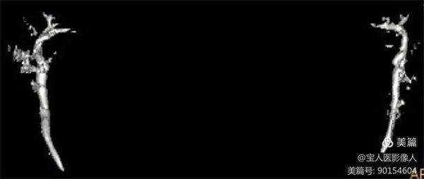 4.webp.jpg 4.webp.jpg