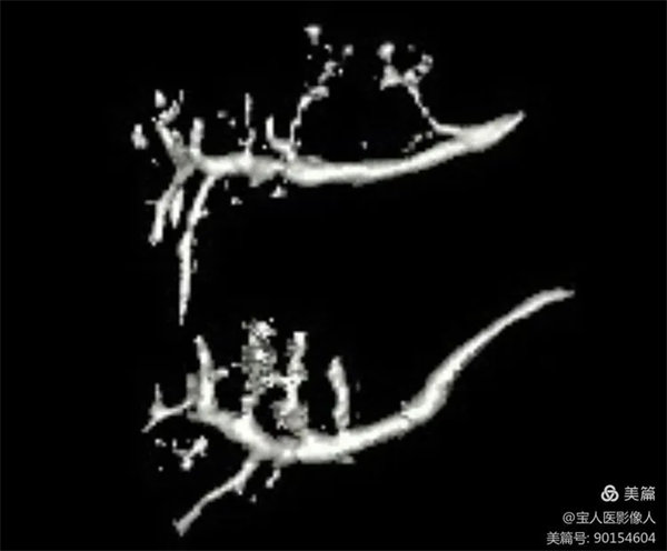 5.webp.jpg 5.webp.jpg