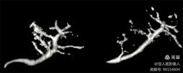 6.webp.jpg 6.webp.jpg