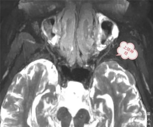 4.webp.jpg 4.webp.jpg