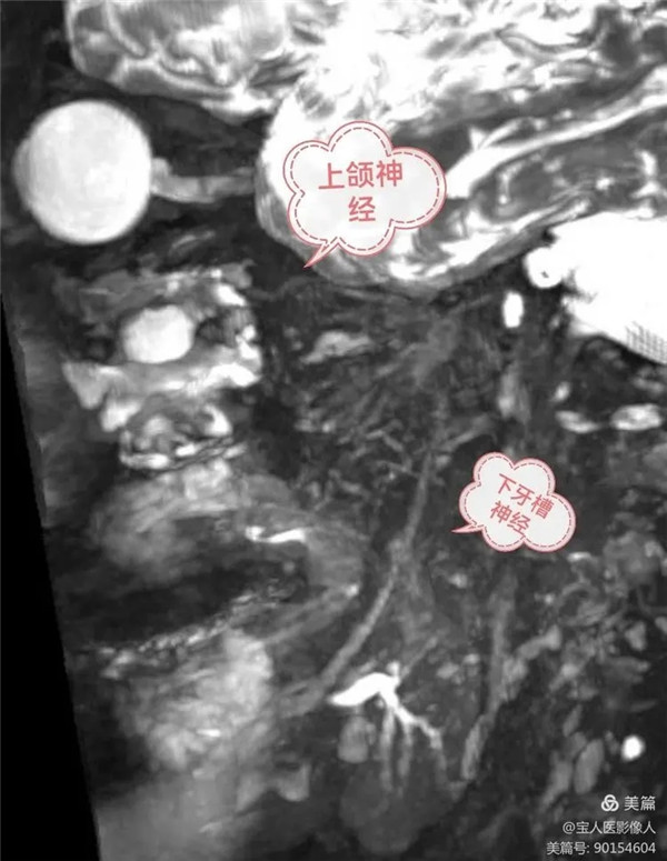 7.webp.jpg 7.webp.jpg