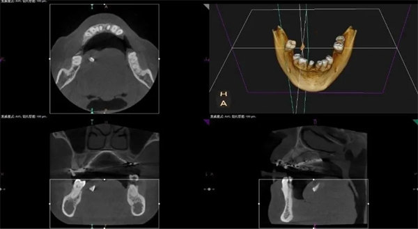 2.webp.jpg 2.webp.jpg