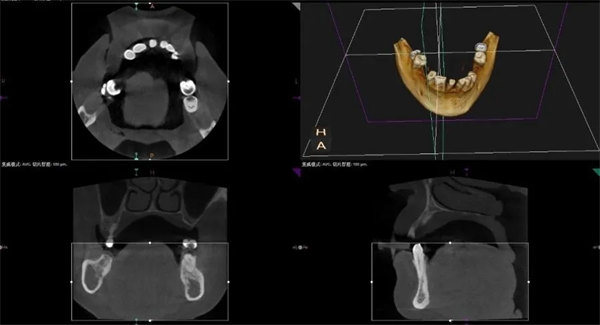4.webp.jpg 4.webp.jpg