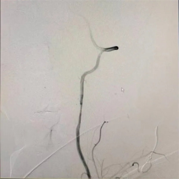 2.webp.jpg 2.webp.jpg