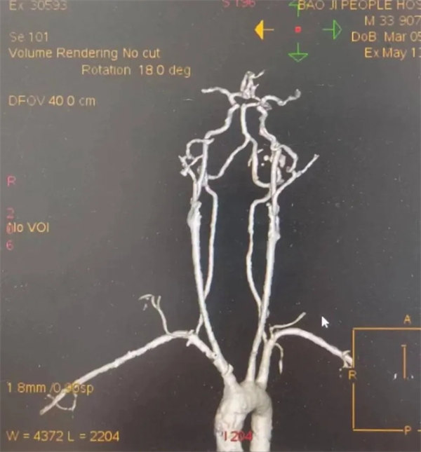 3.webp.jpg 3.webp.jpg