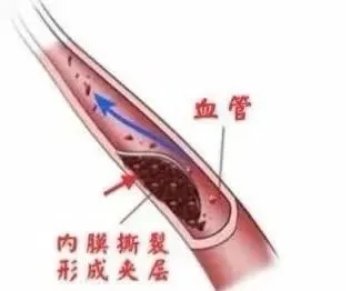 6.webp.jpg 6.webp.jpg