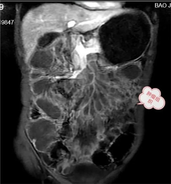 3.webp.jpg 3.webp.jpg