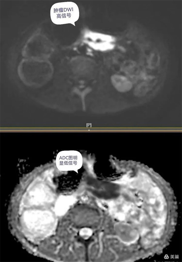 5.webp.jpg 5.webp.jpg