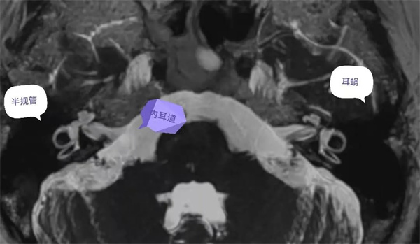 2.webp.jpg 2.webp.jpg