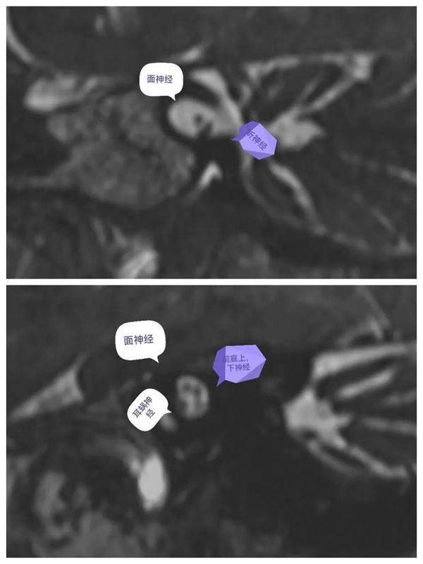 5.webp.jpg 5.webp.jpg