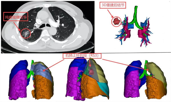 2.webp.jpg 2.webp.jpg
