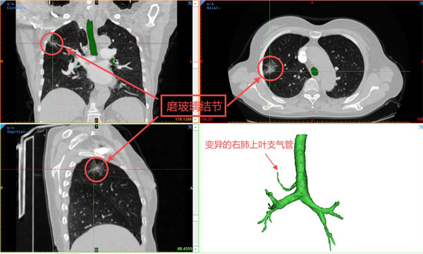 4.webp.jpg 4.webp.jpg