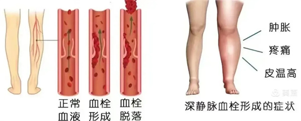 3.webp.jpg 3.webp.jpg