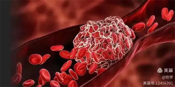 4.webp.jpg 4.webp.jpg