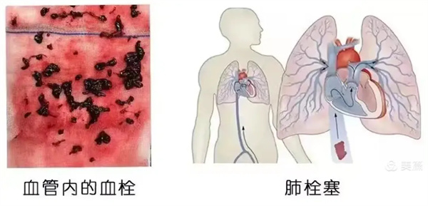 5.webp.jpg 5.webp.jpg