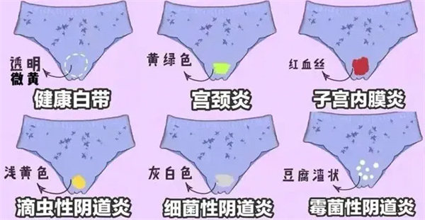 3.webp.jpg 3.webp.jpg