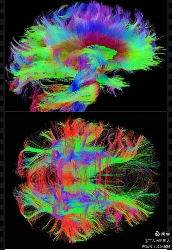 1.webp.jpg 1.webp.jpg