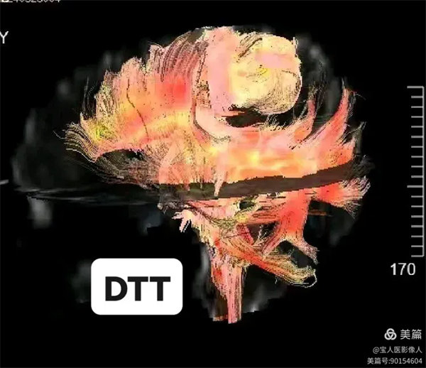 2.webp.jpg 2.webp.jpg