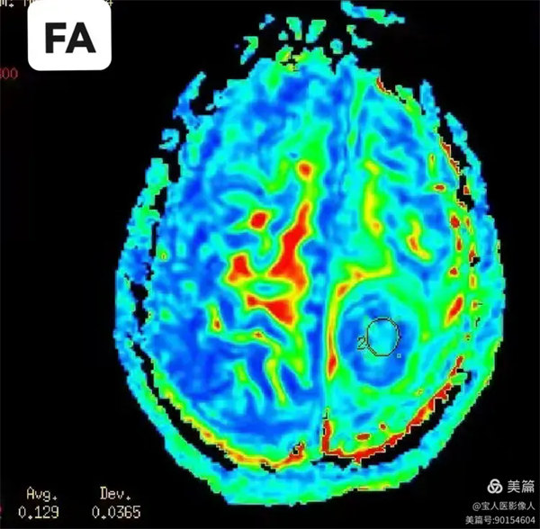 5.webp.jpg 5.webp.jpg