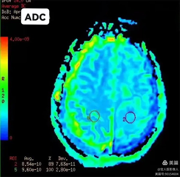 6.webp.jpg 6.webp.jpg