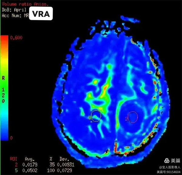 7.webp.jpg 7.webp.jpg