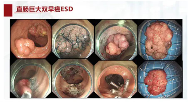 10.webp.jpg 10.webp.jpg