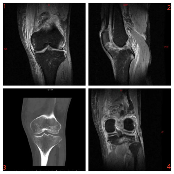 2.webp.jpg 2.webp.jpg