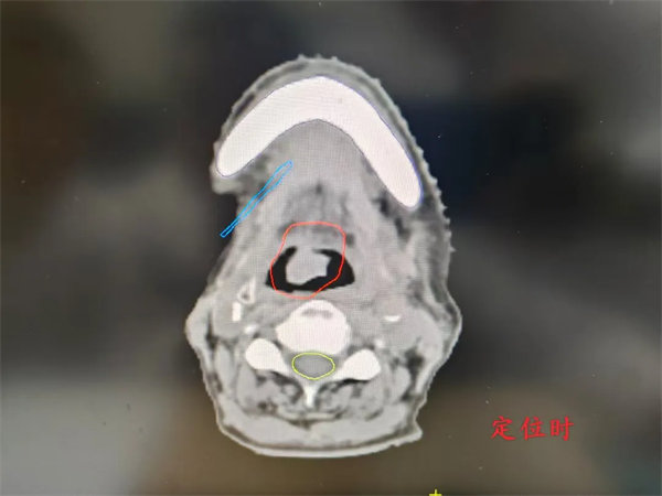 1.webp.jpg 1.webp.jpg