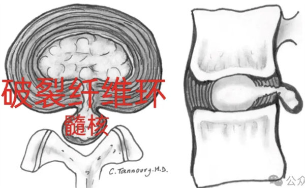 3.webp.jpg 3.webp.jpg